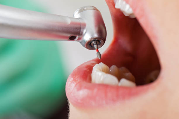 Best Emergency Broken Tooth Repair in Lakehills, TX